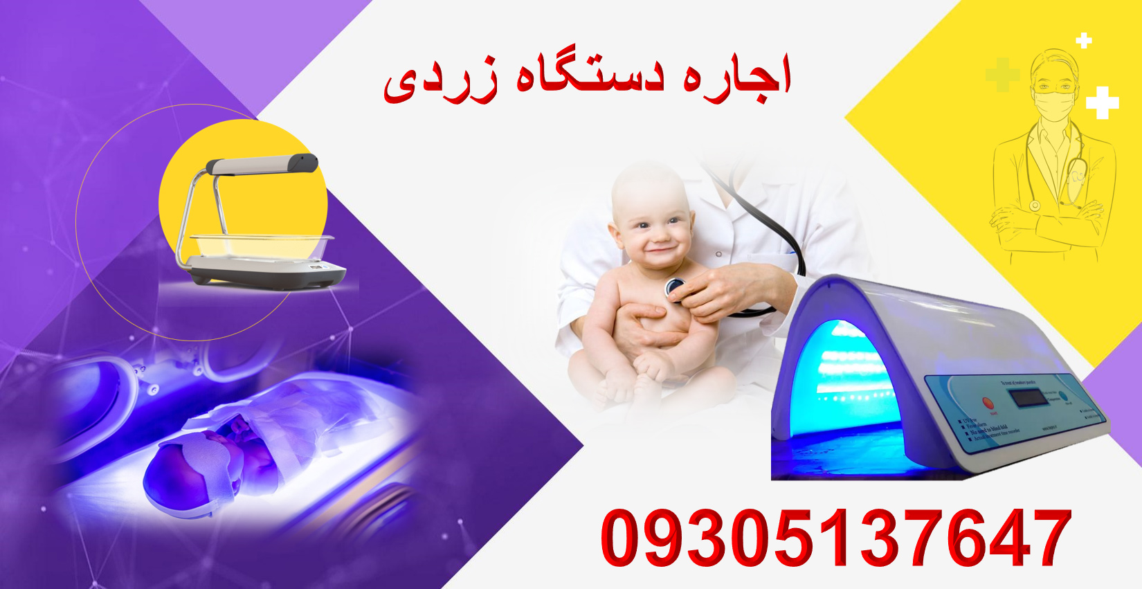 اجاره دستگاه زردی نوزاد در تهران
